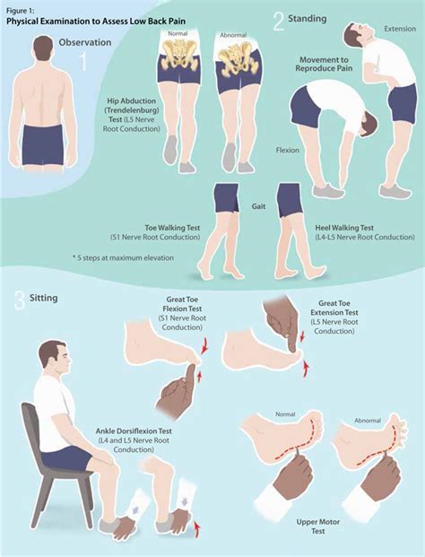 low back pain assessment